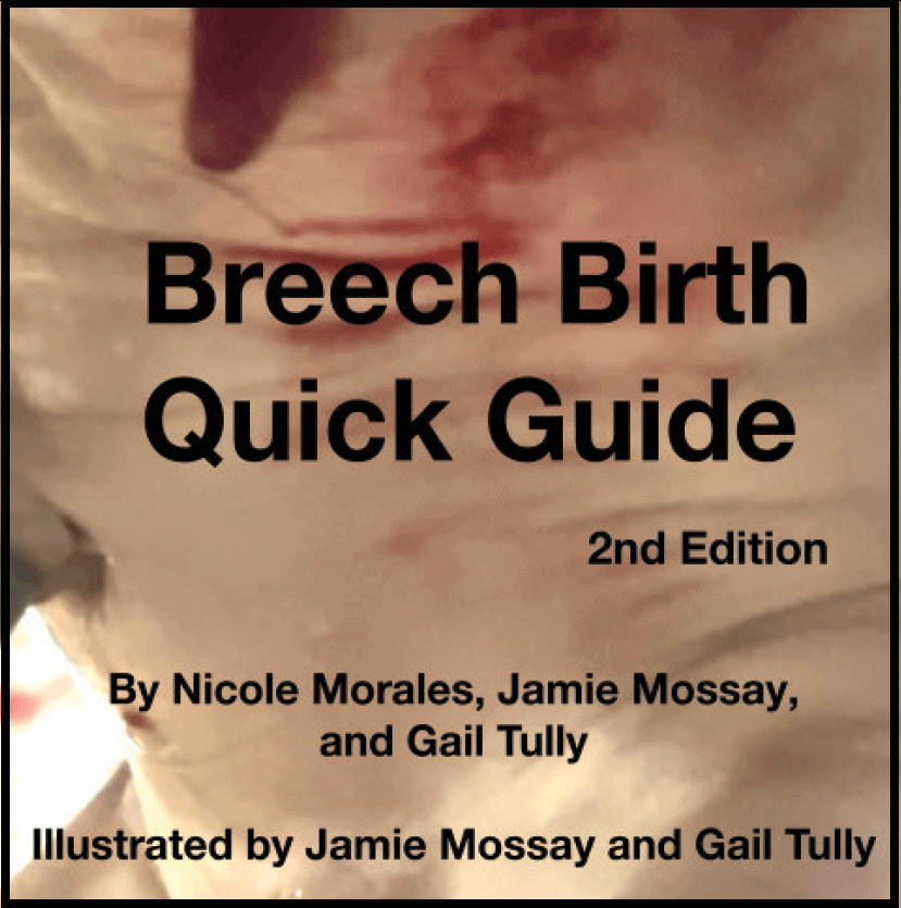 Breech Birth Quick Guide, 2nd Edition by Nicole Morales, Jamie Mossay and Gail Tully