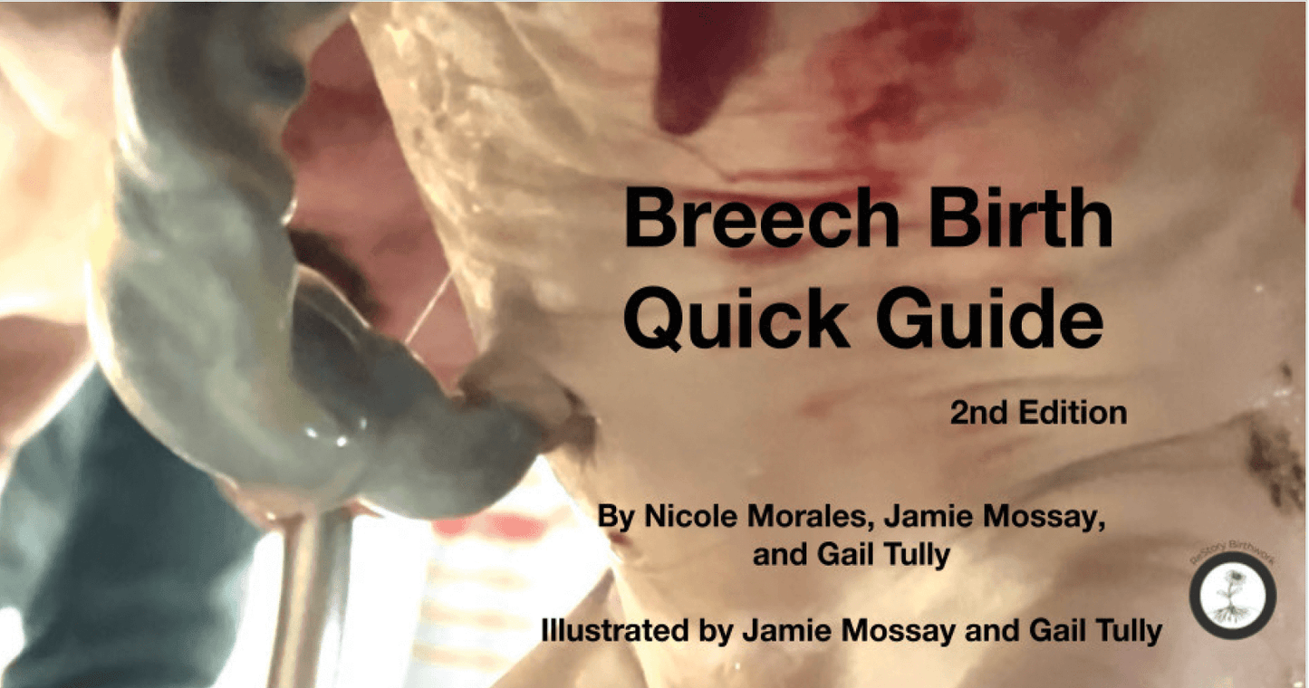 Breech Birth Quick Guide, 2nd Edition by Nicole Morales, Jamie Mossay and Gail Tully